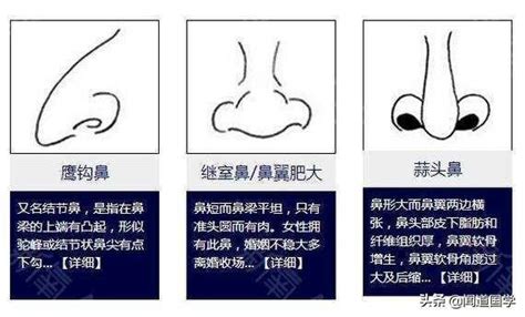 肉鼻子面相|面相學之鼻型解析、全面解讀鼻子與命運